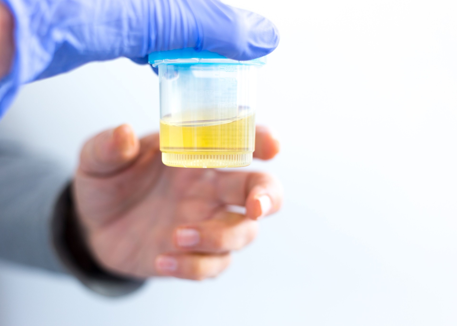 Lab Test: Handing Over Urine Sample to Medical Personnel