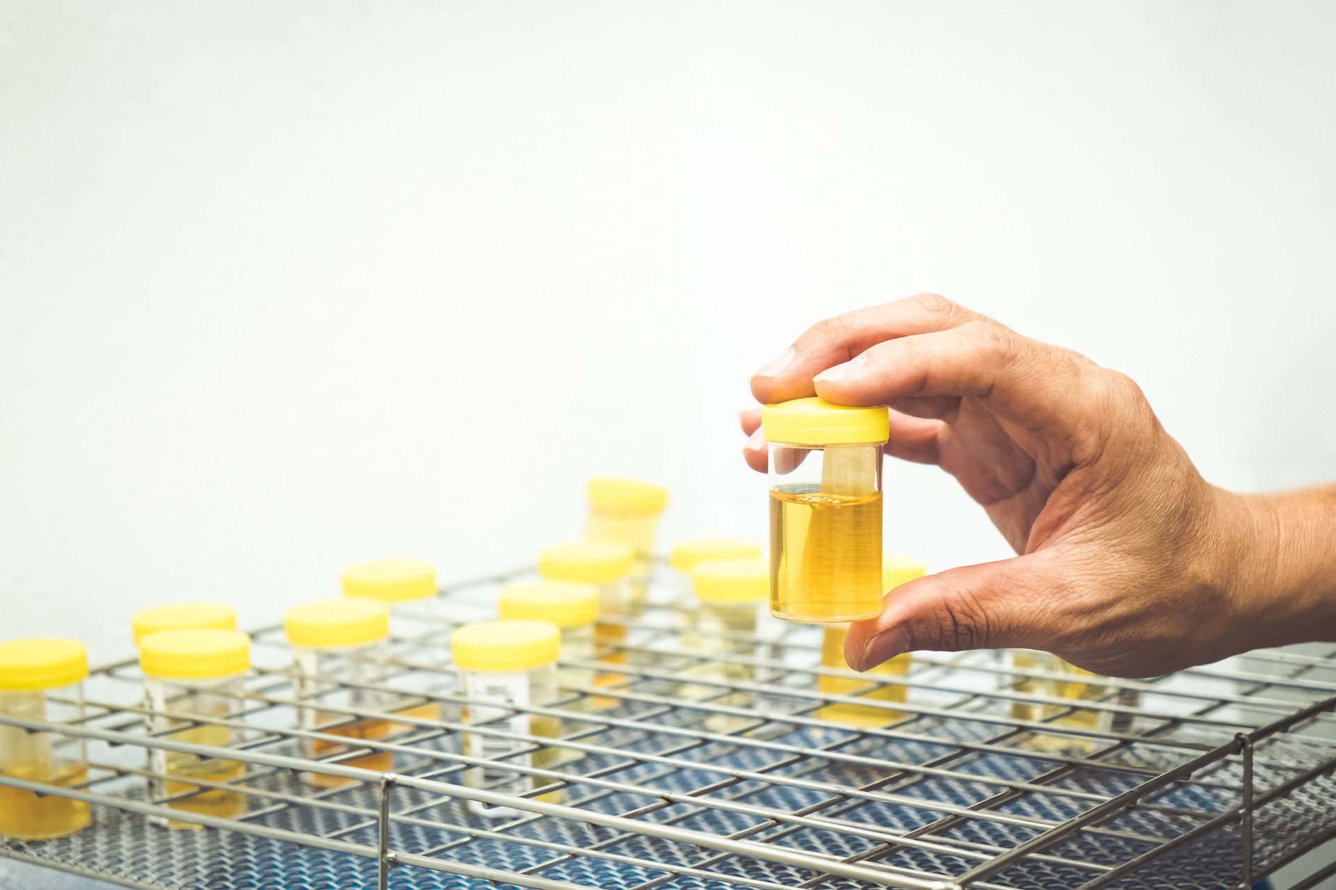 Hand holding for urinalysis in laboratory on white background